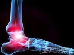 胫腓下联合前部分离