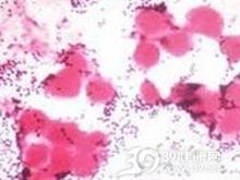 金黄色葡萄球菌脑膜炎