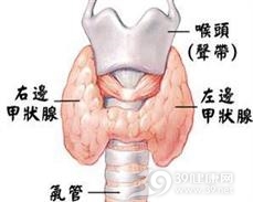 结节性甲状腺肿