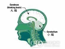 脊髓小脑变性症