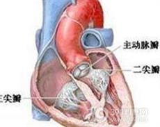 加速性室性自主心律