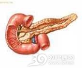 急性出血坏死型胰腺炎