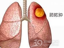 急性肺脓肿