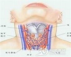 急性化脓性甲状腺炎