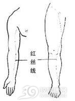 急性淋巴管炎
