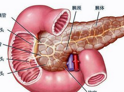 急性水肿型胰腺炎