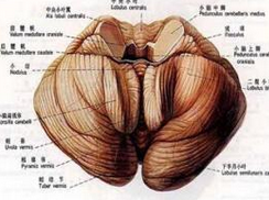 酒中毒性小脑变性