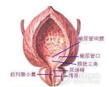 间质性膀胱炎