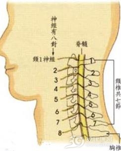 颈椎椎管狭窄症