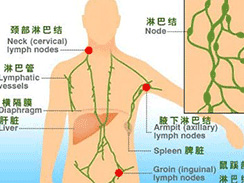 淋巴瘤