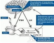 卵巢过度刺激综合征