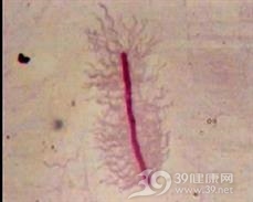 流感嗜血杆菌肺炎