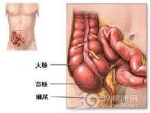 老年急性阑尾炎