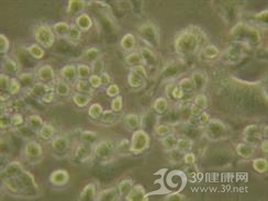 老年人嗜铬细胞瘤危象