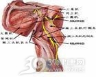 麻痹性臂丛神经炎