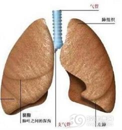 棉尘肺