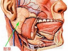 慢性化脓性腮腺炎