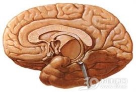 脑出血后遗症
