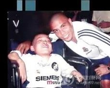 黏多糖贮积症Ⅶ型