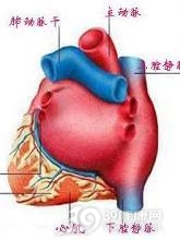 尿毒症性心肌病