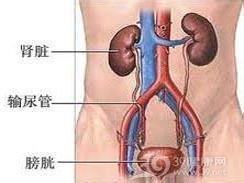 尿路软斑症