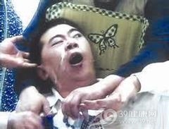 全面性发作