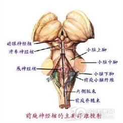 前庭神经炎