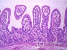 热带口炎性腹泻