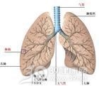 热带型肺嗜酸性粒细胞肺炎