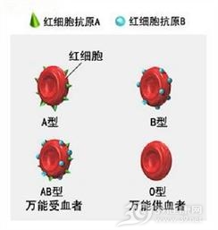 Rh血型不合溶血病