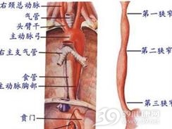 食管贲门黏膜撕裂综合征