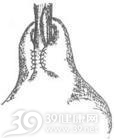 食管失弛缓症