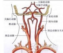 锁骨下动脉盗血综合征