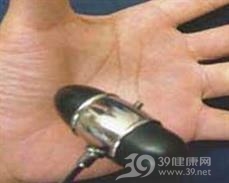神经性肌强直