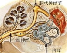神经炎