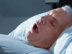 睡眠呼吸暂停综合征