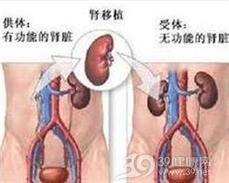 烧伤后急性肾功能衰竭