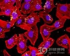 视神经脊髓炎