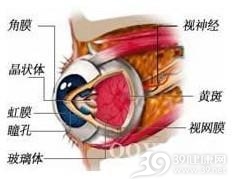 视神经炎
