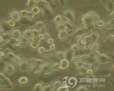 肾上腺意外瘤