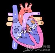 室性逸搏及室性逸搏心律
