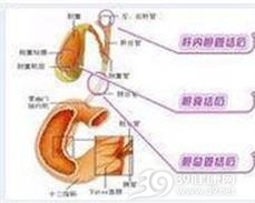 特发性非硬化性门脉高压综合征