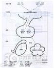 特发性青春期延迟