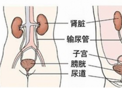 糖尿病并发泌尿系感染