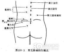 臀上皮神经干痛