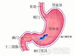 胃窦炎