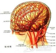 脑萎缩