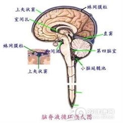 外伤性脑脊液漏