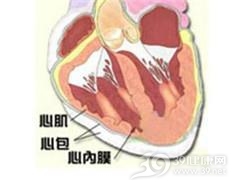 心包积液