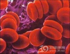 相对性红细胞增多症